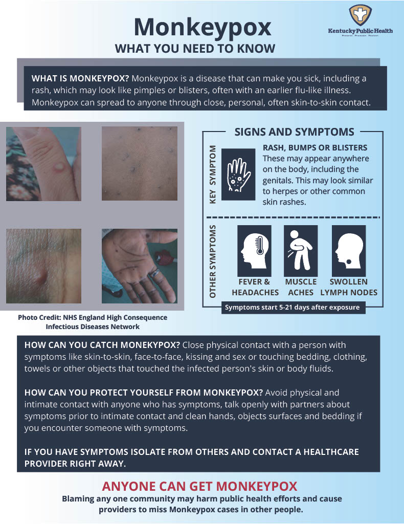 Monkeypox – KDPH One Pager1024_1